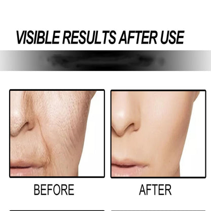 BBOJI Re-aging Serum for Firming, Line Smoothing and Radiance (15ml)